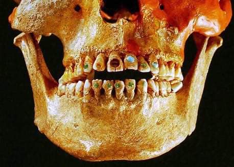 An upper-class girl in Teotihuacan has jeweled teeth.